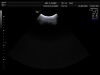 GE AB2-7-D Ultrasound Transducer