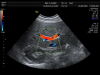 GE AB2-7-D Ultrasound Transducer