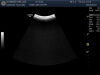 GE C1-6-D Ultrasound Transducer