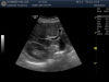 GE C1-6-D Ultrasound Transducer