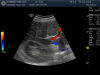 GE C1-6-D Ultrasound Transducer