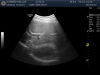 GE C2-6b-D Ultrasound Transducer