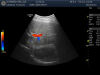 GE C2-6b-D Ultrasound Transducer