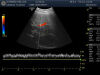GE C2-6b-D Ultrasound Transducer
