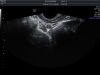 GE IC5-9-D Ultrasound Transducer