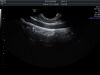 GE IC5-9-D Ultrasound Transducer