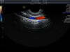 GE IC5-9-D Ultrasound Transducer