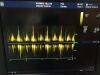 GE P2D Ultrasound Transducer