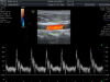 GE RSP6-16-D Ultrasound Transducer
