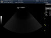 GE S4-10-D Ultrasound Transducer