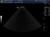 GE S4-10-D Ultrasound Transducer