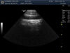 GE S4-10-D Ultrasound Transducer