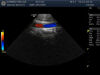 GE S4-10-D Ultrasound Transducer