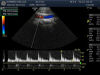 GE S4-10-D Ultrasound Transducer