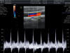 GE SP10-16-D Ultrasound Transducer