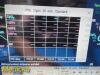 PHILIPS 2012  MP30,W/ M3001A Module, MASIMO SpO2, Printer & Leads ~ Monitor