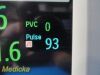 PHILIPS 2012  MP30,W/ M3001A Module, MASIMO SpO2, Printer & Leads ~ Monitor