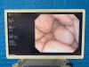 OLYMPUS GIF-Q260 Endoscope