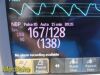 PHILIPS 2012 ,MP30 (Masimo SpO2) W/ Leads & M3001A Module ~ Monitor
