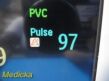 PHILIPS 2010  Intellivue MP30, W/ New Patient Leads & Module MASIMO~ Monitor