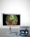 KARL STORZ TC304 ,TC201 4K UHD SYSTEM ICG