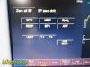 FUKUDA DENSHI DS-7200 Dynascope ,  W/ New Patient Leads ~ Multi-Para Monitor