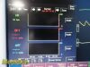 FUKUDA DENSHI DS-7200 Dynascope ,  W/ New Patient Leads ~ Multi-Para Monitor