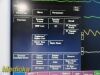 FUKUDA DENSHI DS-7200 Dynascope ,  W/ New Patient Leads ~ Multi-Para Monitor