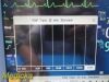 PHILIPS 2012  MP30 Intellivue,Recent PM,Masimo SpO2, Leads & Module~ Monitor