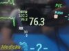 PHILIPS 2012  MP30 Intellivue,Recent PM,Masimo SpO2, Leads & Module~ Monitor