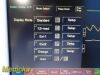 FUKUDA DENSHI Dynascope  , DS-7200 W/ Patient Leads, New ~ Monitor