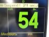 FUKUDA DENSHI Dynascope  , DS-7200 W/ Patient Leads, New ~ Monitor
