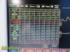 FUKUDA DENSHI 2010  Dynascope ;DS-7200 W/ Leads (NBP ECG SpO2 IBP T)~ Monitor