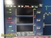 FUKUDA DENSHI 2010 DS-7200 Dynascope  ,W/ NEW Patient Leads ~ Monitor