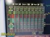 FUKUDA DENSHI 2010 DS-7200 Dynascope  ,W/ NEW Patient Leads ~ Monitor
