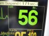 FUKUDA DENSHI 2010 DS-7200 Dynascope  ,W/ NEW Patient Leads ~ Monitor