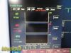 FUKUDA DENSHI DS-7210 / DS-7200,W/ Patient Leads DOM 2010 ~ Patient Monitor