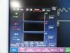 FUKUDA DENSHI DS-7210 Dynascope, W/ SpO2,NBP,ECG,Temp,IBP Leads ~ Monitor