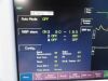 FUKUDA DENSHI 2010  DS-7210 Dynascope & SpO2,NBP,ECG,Temp,IBP Leads~ Monitor
