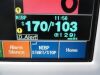 FUKUDA DENSHI 2010  DS-7210 Dynascope & SpO2,NBP,ECG,Temp,IBP Leads~ Monitor