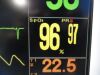 FUKUDA DENSHI 2010  DS-7210 Dynascope & SpO2,NBP,ECG,Temp,IBP Leads~ Monitor