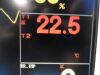FUKUDA DENSHI 2010  DS-7210 Dynascope & SpO2,NBP,ECG,Temp,IBP Leads~ Monitor