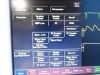 FUKUDA DENSHI 2010  DS-7210 Dynascope & SpO2,NBP,ECG,Temp,IBP Leads~ Monitor