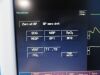 FUKUDA DENSHI 2010  DS-7210 Dynascope & SpO2,NBP,ECG,Temp,IBP Leads~ Monitor