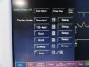 FUKUDA DENSHI 2010  DS-7210 Dynascope & SpO2,NBP,ECG,Temp,IBP Leads~ Monitor