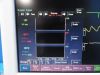 FUKUDA DENSHI 2010  DS-7210 Dynascope & SpO2,NBP,ECG,Temp,IBP Leads~ Monitor