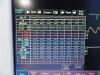 FUKUDA DENSHI 2010  DS-7210 Dynascope & SpO2,NBP,ECG,Temp,IBP Leads~ Monitor
