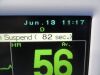 FUKUDA DENSHI 2010  DS-7210/DS-7200 Dynascope Monitor