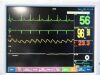 FUKUDA DENSHI 2010  DS-7210/DS-7200 Dynascope Monitor