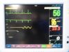 FUKUDA DENSHI 2010  DS-7210/DS-7200 Dynascope Monitor